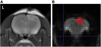 The Value of First-Order Features Based on the Apparent Diffusion Coefficient Map in Evaluating the Therapeutic Effect of Low-Intensity Pulsed Ultrasound for Acute Traumatic Brain Injury With a Rat Model